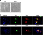 Identification and BAC construction of Han, the first characterized HCMV clinical strain in China